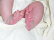 feet 2